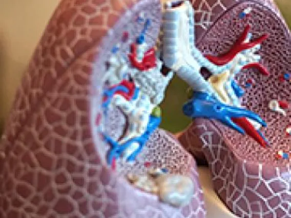 Characterizing Adaptive Immune Response in Emphysema Patients to Better Inform Personalized Treatments